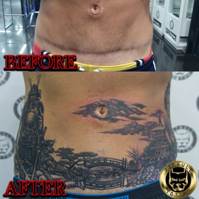 Over Scars Tattoo Specializations